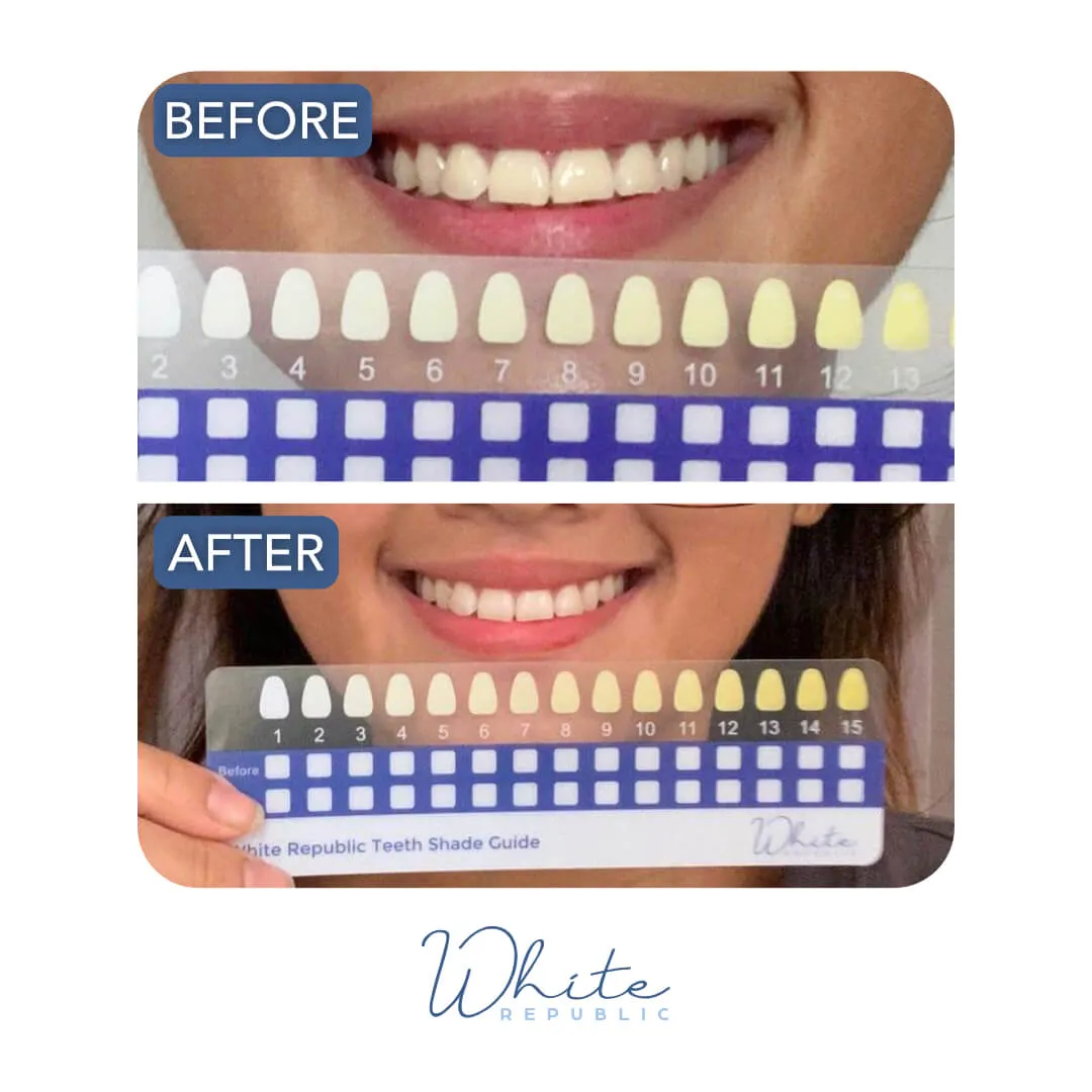 White Republic Extra Strength Teeth Whitening Pen